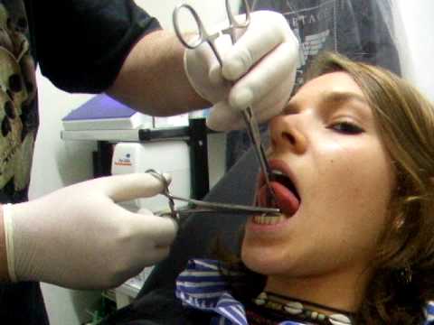 comment soulager un piercing a la langue