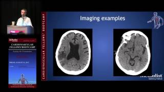 Download Lagu Diagnosis and Medical Management of Stroke (John J. Volpi, MD) Thumbnail