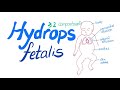 Hydrops fetalis