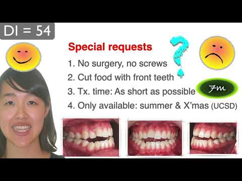 CC374. American Association of Orthodontists AAO 2016 Chris Part 2