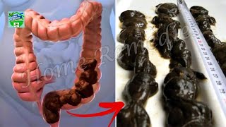 How To Clean Your Stomach and Intestines Naturally in One Day