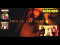Skindred drop new song “This Is The Sound” off album “You Got This“ + tour dates