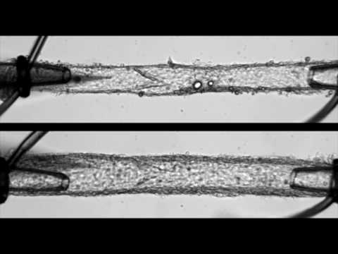 RASA1 deficiency impairs lymphatic valve closure in response to pressure
