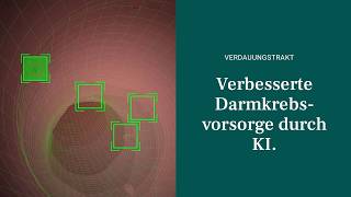 Künstliche Intelligenz in der Darmspiegelung an der Privatklinik Confraternität & Goldenes Kreuz