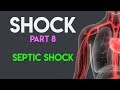 Septic Shock | Shock (Part 8)