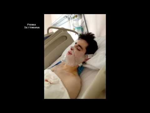 Mal di testa parte bassa della schiena e vomito Incontinenza intervertebrale ernia
