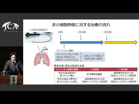 栄養学科 講演2「肺癌薬物療法の進歩と今後の展望」岩間 映二（九州大学大学院 医学研究院 呼吸器内科学分野）