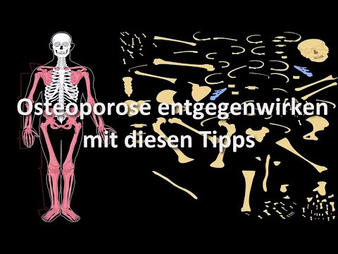Sehr wunden Rücken Bauch Kunststoff Hüfte