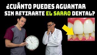 ¿Cuánto puedo aguantar sin mi limpieza dental ¿Realmente se debe retirar el sarro cada 6 meses