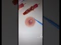 Paramedical Tattoo For Breast Cancer Survivors