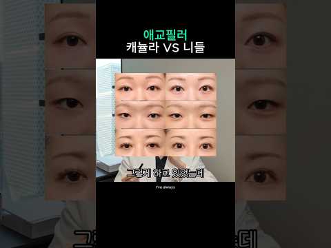애교필러 니들로 하는 이유