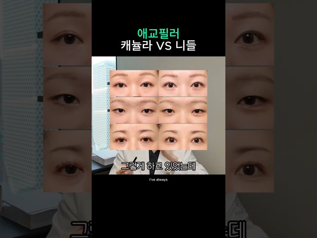 애교필러 니들로 하는 이유