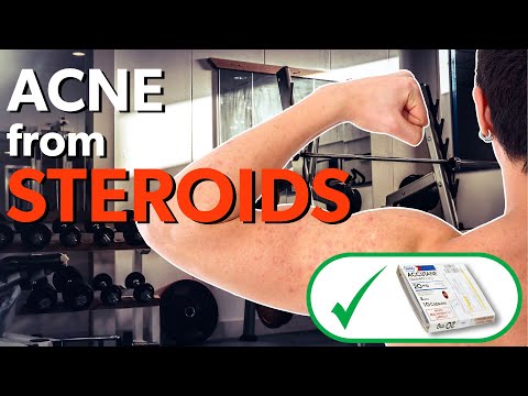 Steroid Induced Acne - How to treat | Dr Davin Lim