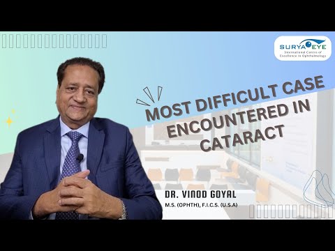 Dr. Vinod Goyal shares some of the most difficult case encountered in Cataract #suryaeyeinstitute