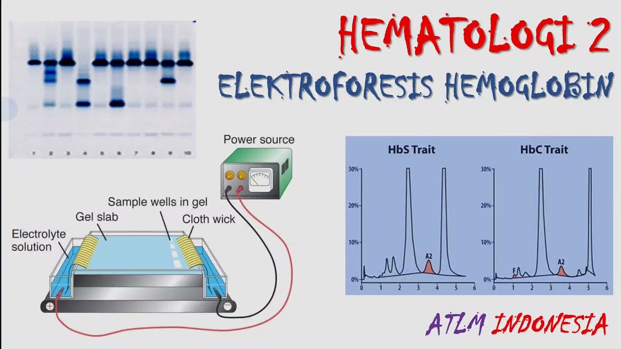 Elektroforesis Hemoglobin | Analis Kesehatan | TLM | Materi Kuliah Hematologi