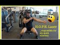 Shoudler Workout 12 Days Post Dual Pec Tear