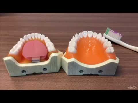 DRD(PerioIII) Grupo 8: Instrução de higiene oral