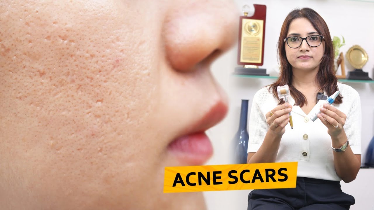 Company video MAHI SKIN, HAIR & LASER CLINIC, KILPAUK