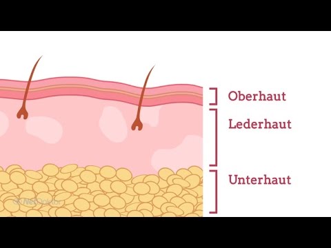 Ob der Sud des Hafers bei der Schuppenflechte hilft Gistan und die Schuppenflechte