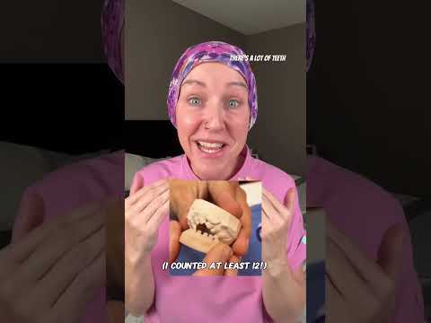 Baby pacifiers = ugly baby? #pacifier #babycare #breastfeedingtips #expectingmom #pacifiers #newborn