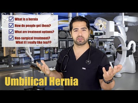 Whats the deal with umbilical hernias? Let's talk all about belly button hernias