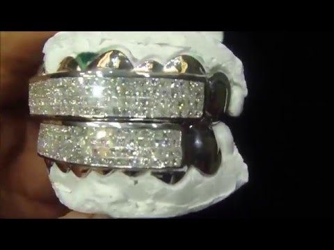 Custom Diamond Princess Cut Grillz 14K White Gold Atlanta Jeweler