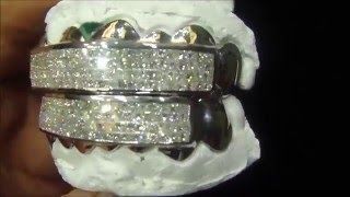 Custom Diamond Princess Cut Grillz 14K White Gold Atlanta Jeweler