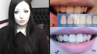 Home Teeth Whitening | Toxic Tears