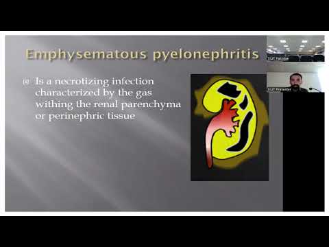 Specific Infections of GU tract II Causes Symptoms, Diagnosis & Treatment II #Urology #siuteducation