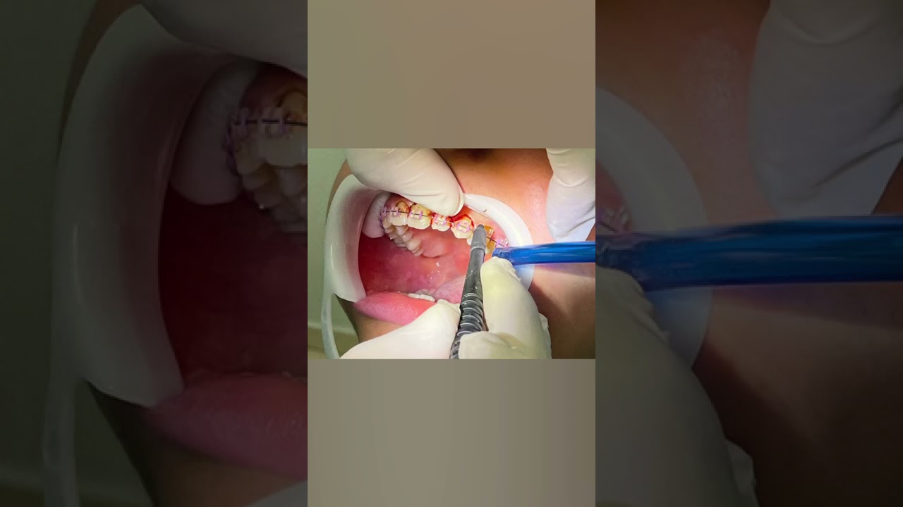 Yorgel Reyes Alvarez-5