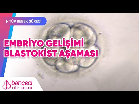 Embriyo Gelişimi- Blastokist Aşaması