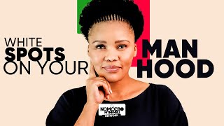 Download lagu Amaqhubu Amhlophe Kwi Pipi | White Spots on Your Manhood: What They Really Mean mp3 Download lagu Amaqhubu Amhlophe Kwi Pipi | White Spots on Your Manhood: What They Really Mean mp3