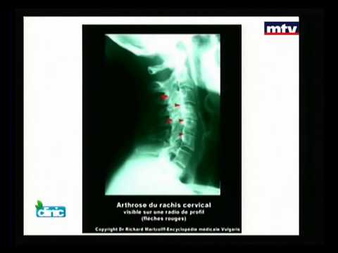 CLINIC - Dr Pierre Gemayel 21/08/2014