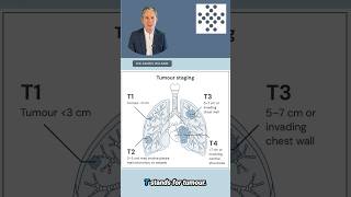 Download lagu Lung Cancer Staging: What T, N, and M Really Mean mp3 Download lagu Lung Cancer Staging: What T, N, and M Really Mean mp3