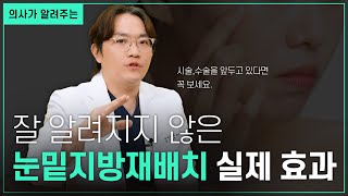 EDITION TV - 눈밑지방재배치 제대로 알고 하세요 | 사람마다 너무 다른 눈밑지방재배치