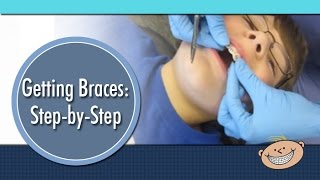 preview picture of video 'Getting Braces - Lakeville Orthodontics 952-435-4000 Orthodontist'