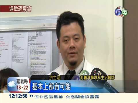 研究:鼻過敏 罹鼻咽癌率高1.25倍