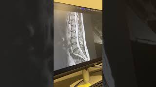 Progressive Spine & Orthopaedics