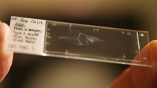 UVA Researchers Find Link Between Brain and Immune System