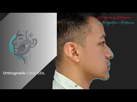 Miguel Ángel Moreno Alba-19