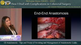 GI Anastomosis - Tips and Tricks of Avoiding and Management of Anastomotic Leaks