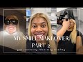 MY SMILE MAKEOVER (PART 2) 😁 | TEETH WHITENING, GUM CONTOURING, COMPOSITE BONDING