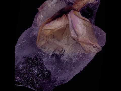 Cynthia Spiering - A Nightmare (Courtoisy)