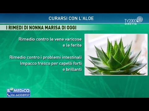 donna de la varicose