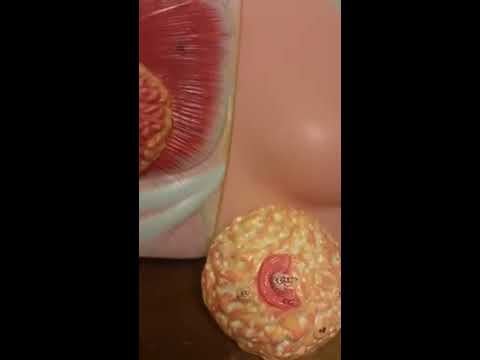 Mga review ng mga lacquers mula sa kuko halamang-singaw Saktan ang kuko sa paa halamang-singaw