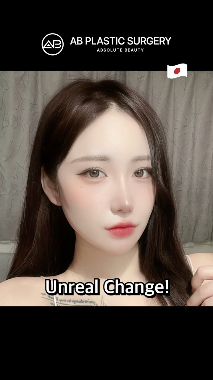 Unrecognizable Before & After!