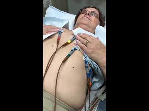 12 lead Ekg ecg lead placement intro