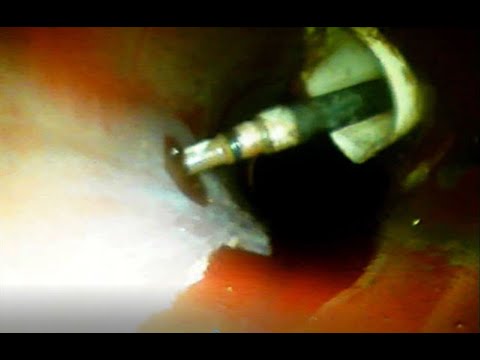 Blocked Drain 58 (Stuff you find in drains)