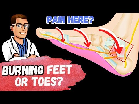 Heel Spurs Plantar Fasciitis BEST Home Treatment 2022