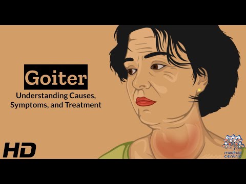 Meniere s disease Everything You Need to Know